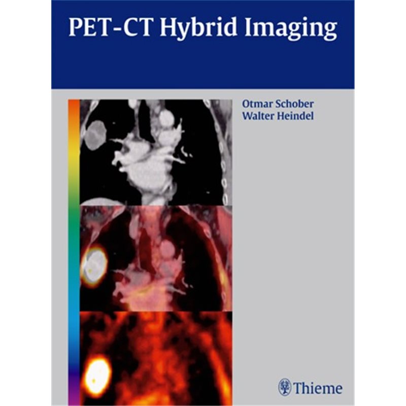 PET-CT Hybrid Imaging